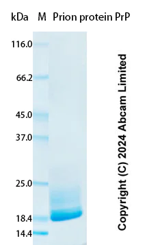 SDS-PAGE - Recombinant Human Prion protein PrP Protein Standard (AB323081)