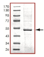 SDS-PAGE - Recombinant Human PRKAR1A protein (AB125532)