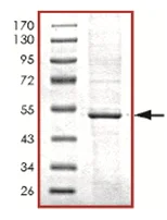 SDS-PAGE - Recombinant Human PRKAR1A protein (AB125532)