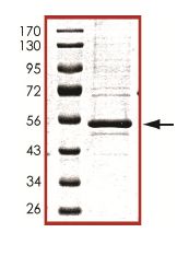 SDS-PAGE - Recombinant Human PRKAR1B protein (AB102106)