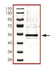 SDS-PAGE - Recombinant Human PRKAR1B protein (AB102106)