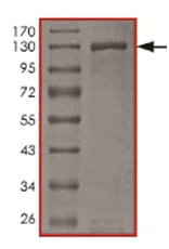 SDS-PAGE - Recombinant human PRKD2 (mutated G870E) protein (AB167923)