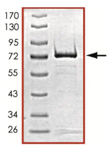 SDS-PAGE - Recombinant human PRKX protein (AB125604)