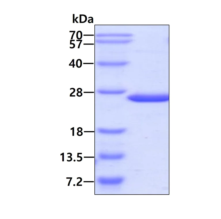 SDS-PAGE - Recombinant Human PRL-1 protein (AB101827)