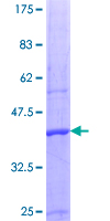 SDS-PAGE - Recombinant Human PRMT5 protein (AB153079), expandable thumbnail