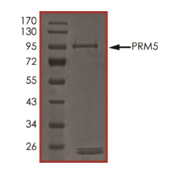 SDS-PAGE - Recombinant Human PRMT5 protein (Tagged) (AB268889), expandable thumbnail