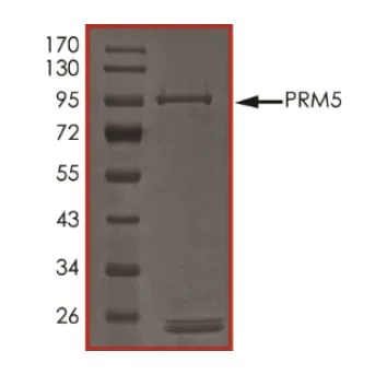 SDS-PAGE - Recombinant Human PRMT5 protein (Tagged) (AB268889)