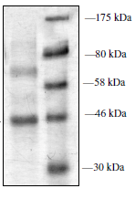 Recombinant human PRMT6 protein