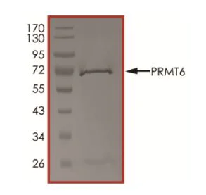 SDS-PAGE - Recombinant human PRMT6 protein (Active) (AB268890)