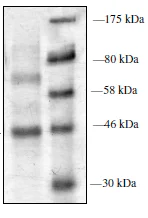 SDS-PAGE - Recombinant human PRMT6 protein (His tag N-Terminus) (AB196434)