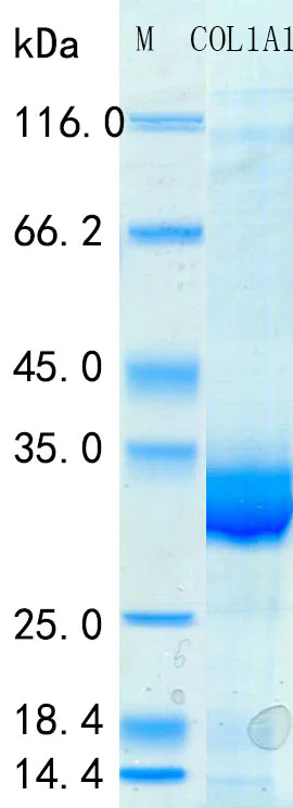 SDS-PAGE - Recombinant Human Pro-Collagen I C-Terminal Propeptide Protein Standard (His tag) (AB316457)