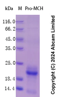 SDS-PAGE - Recombinant Human Pro-MCH Protein Standard (His tag) (AB323139)