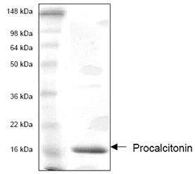 SDS-PAGE - Recombinant Human Procalcitonin protein (AB53369)