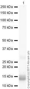 Recombinant Human Procalcitonin protein
