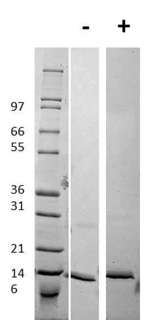 Western blot - Recombinant Human Procalcitonin protein (AB92843)