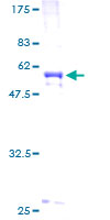 Recombinant Human procollagen type IIA protein