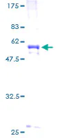 SDS-PAGE - Recombinant Human procollagen type IIA protein (GST tag N-Terminus) (AB158154)
