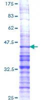 SDS-PAGE - Recombinant Human ProDynorphin protein (AB159086)