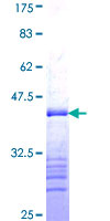 SDS-PAGE - Recombinant Human Progesterone Receptor protein (AB159105)