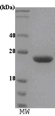 SDS-PAGE - Recombinant Human Prolactin/PRL protein (Tag Free) (AB48823)