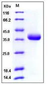 SDS-PAGE - Recombinant Human Prolactin Receptor/PRL-R protein (His tag) (AB276239)