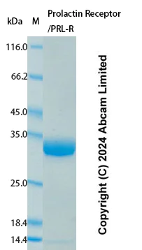 SDS-PAGE - Recombinant Human Prolactin Receptor/PRL-R Protein Standard (AB323047)