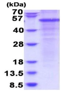 SDS-PAGE - Recombinant Human Properdin/PFC protein (denatured) (AB180316)