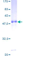 SDS-PAGE - Recombinant Human Proprotein convertase PC4 (GST tag N-Terminus) (AB162833)