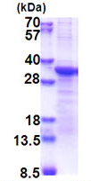 SDS-PAGE - Recombinant Human ProSAAS protein (denatured) (AB174456)