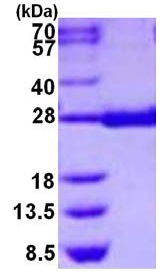 Recombinant Human Prostaglandin D Synthase (hematopoietic) protein