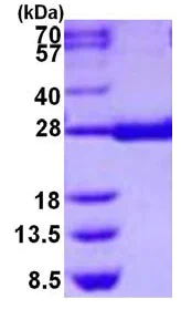 SDS-PAGE - Recombinant Human Prostaglandin D Synthase (hematopoietic) protein (AB126698)
