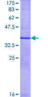 Recombinant Human Prostaglandin E Synthase/MPGES-1 protein