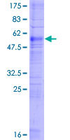 Recombinant Human Prostaglandin F2 alpha Receptor/PTGFR protein