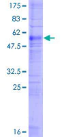SDS-PAGE - Recombinant Human Prostaglandin F2 alpha Receptor/PTGFR protein (AB159276)