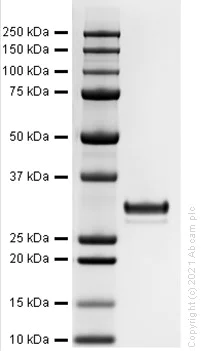 SDS-PAGE - Recombinant Human Prostate Specific Antigen protein (AB283430)