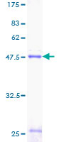 Recombinant Human Prosurfactant Protein C