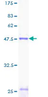 SDS-PAGE - Recombinant Human Prosurfactant Protein C (GST tag N-Terminus) (AB114293)