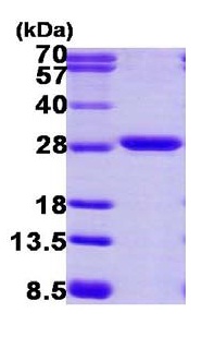 SDS-PAGE - Recombinant Human Proteasome 20S alpha 2/HC3 protein (AB116173)