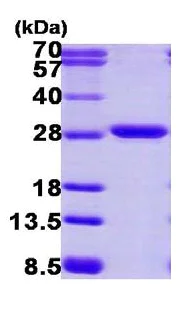 SDS-PAGE - Recombinant Human Proteasome 20S alpha 2/HC3 protein (His tag N-Terminus) (AB116173)