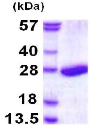 SDS-PAGE - Recombinant Human Proteasome 20S beta 3 protein (AB117227), expandable thumbnail