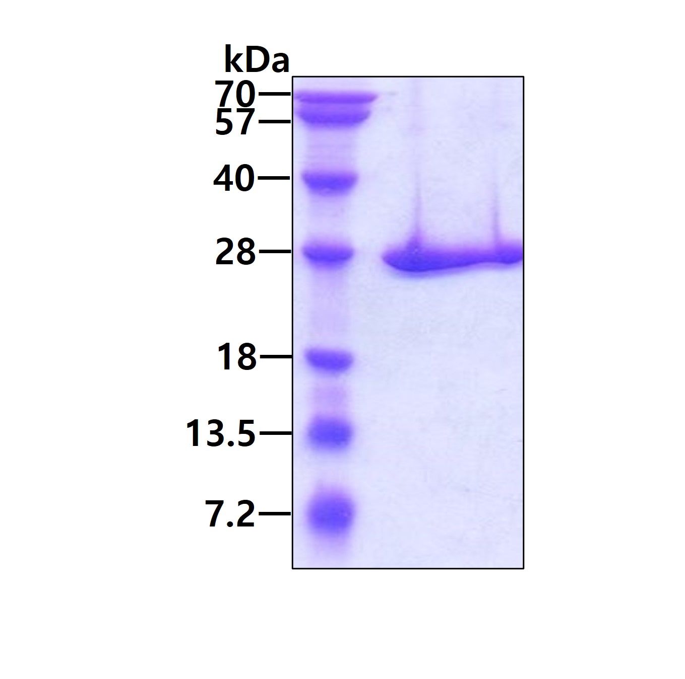 SDS-PAGE - Recombinant Human Proteasome 20S beta 3 protein (His tag N-Terminus) (AB117227)