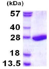 SDS-PAGE - Recombinant Human Proteasome 20S beta 3 protein (His tag N-Terminus) (AB117227)