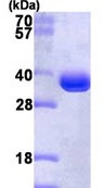 SDS-PAGE - Recombinant Human Proteasome 20S C2/HC2 protein (AB116156), expandable thumbnail