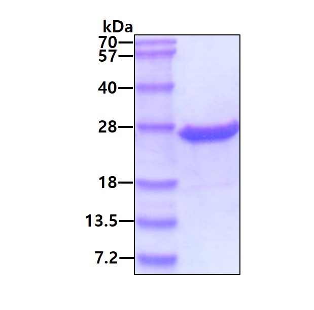 SDS-PAGE - Recombinant Human Proteasome 20S LMP2 protein (His tag N-Terminus) (AB105592)