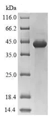 SDS-PAGE - Recombinant Human Proteasome 20S LMP7 protein (Tagged) (AB236180)