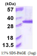 SDS-PAGE - Recombinant Human Proteasome subunit alpha type 6 protein (AB117226)