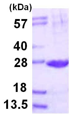 SDS-PAGE - Recombinant Human Proteasome subunit beta type 2/PSMB2 protein (His tag N-Terminus) (AB116169)