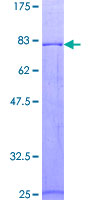 Recombinant Human Protein C