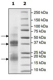 SDS-PAGE - Recombinant human Protein C (His tag C-Terminus) (AB198147)