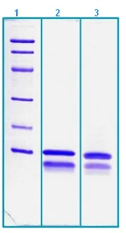 SDS-PAGE - Recombinant Human Protein FAM19A5 (AB203547)
